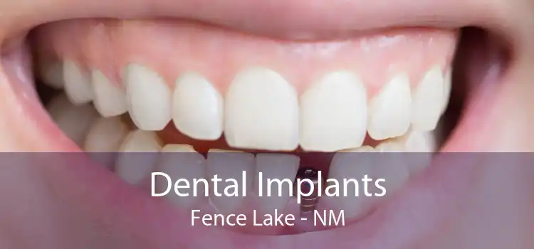 Dental Implants Fence Lake - NM