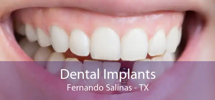Dental Implants Fernando Salinas - TX