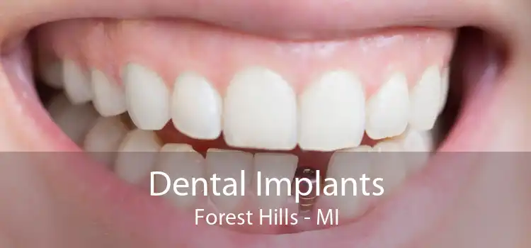 Dental Implants Forest Hills - MI