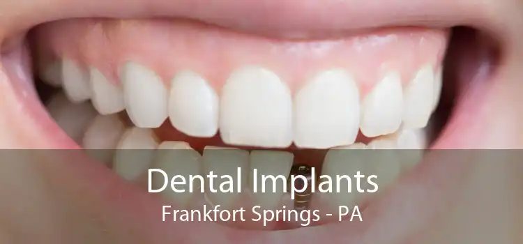 Dental Implants Frankfort Springs - PA