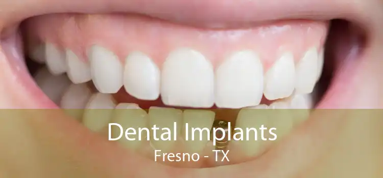 Dental Implants Fresno - TX