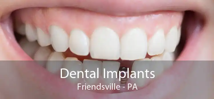 Dental Implants Friendsville - PA