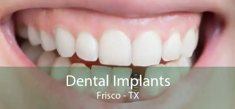 Dental Implants Frisco - TX