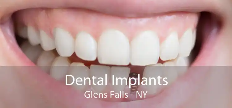 Dental Implants Glens Falls - NY