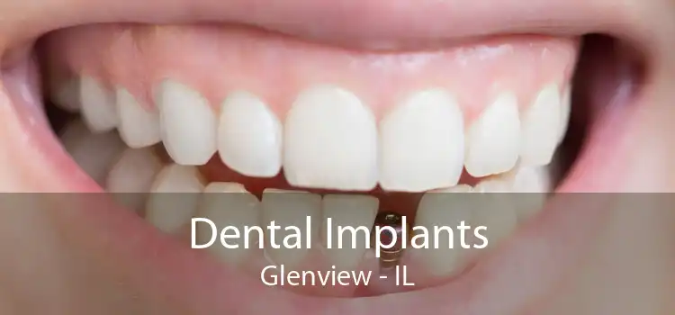 Dental Implants Glenview - IL