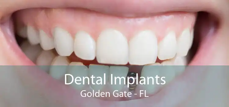 Dental Implants Golden Gate - FL