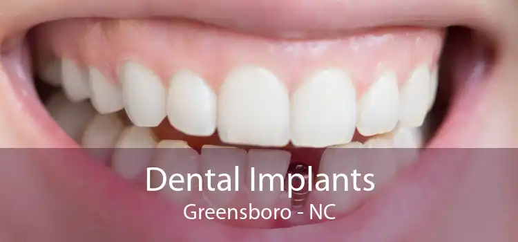 Dental Implants Greensboro - NC