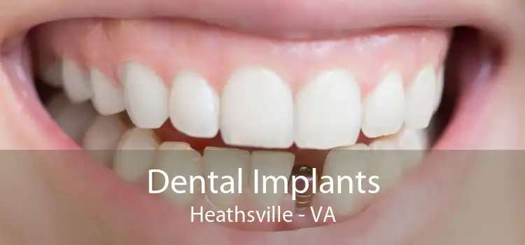Dental Implants Heathsville - VA