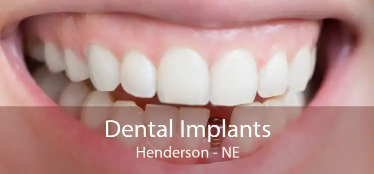 Dental Implants Henderson - NE