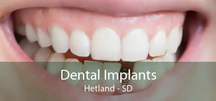 Dental Implants Hetland - SD