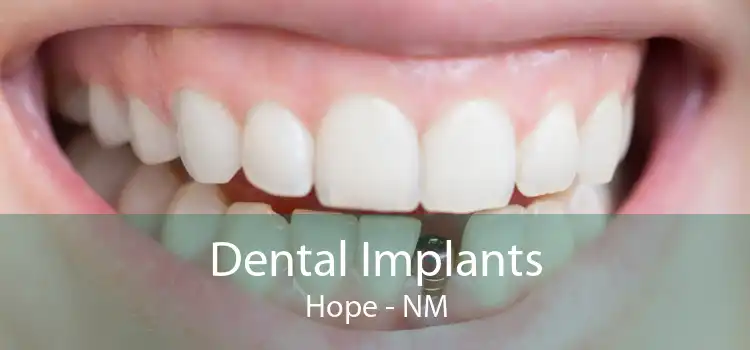 Dental Implants Hope - NM