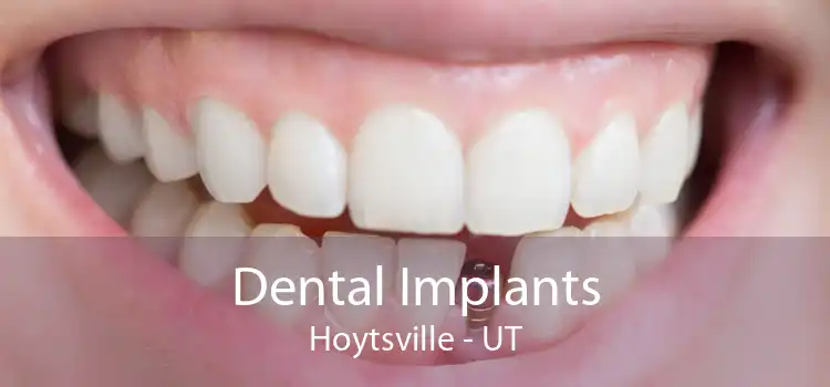 Dental Implants Hoytsville - UT