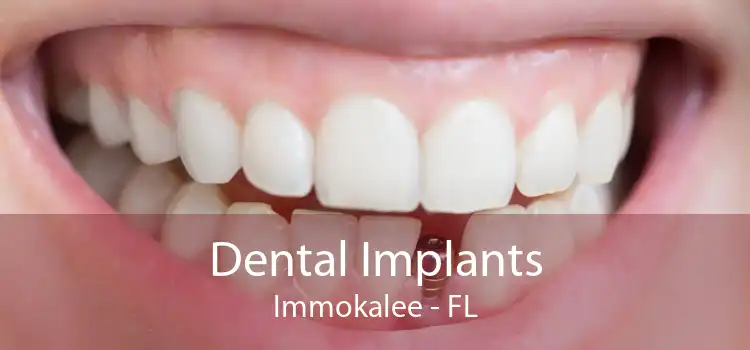 Dental Implants Immokalee - FL
