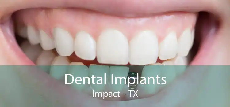 Dental Implants Impact - TX