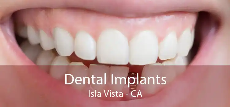 Dental Implants Isla Vista - CA