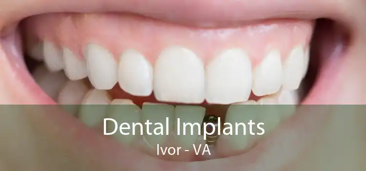 Dental Implants Ivor - VA