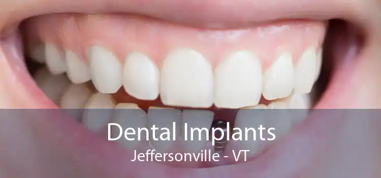Dental Implants Jeffersonville - VT