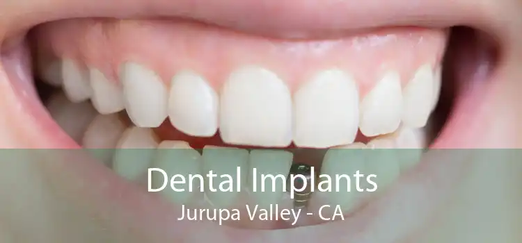 Dental Implants Jurupa Valley - CA