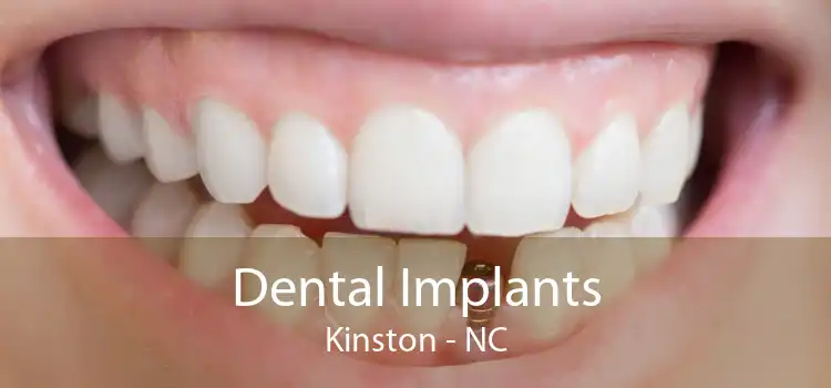 Dental Implants Kinston - NC