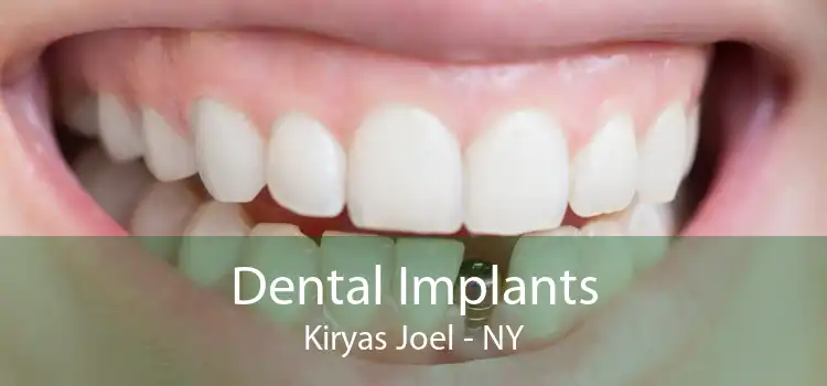Dental Implants Kiryas Joel - NY