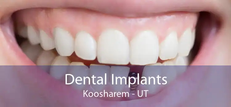Dental Implants Koosharem - UT