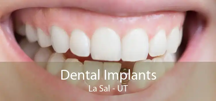 Dental Implants La Sal - UT