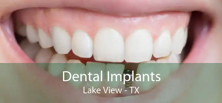 Dental Implants Lake View - TX
