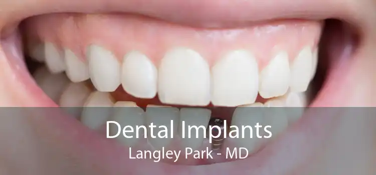 Dental Implants Langley Park - MD