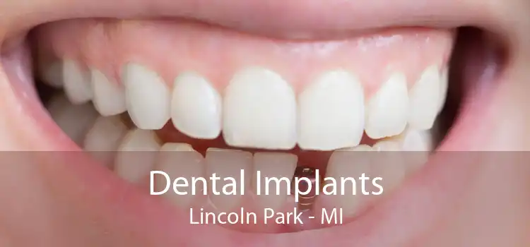 Dental Implants Lincoln Park - MI