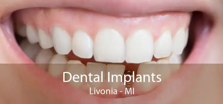 Dental Implants Livonia - MI