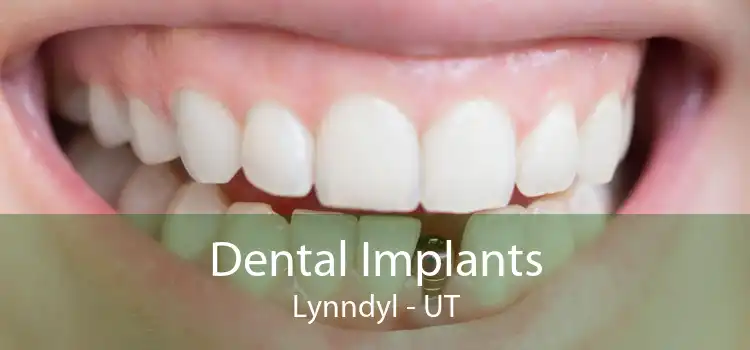 Dental Implants Lynndyl - UT