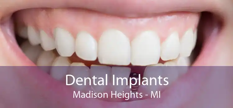 Dental Implants Madison Heights - MI