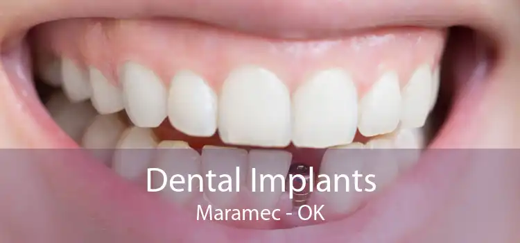 Dental Implants Maramec - OK
