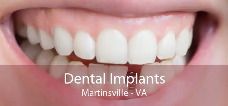 Dental Implants Martinsville - VA