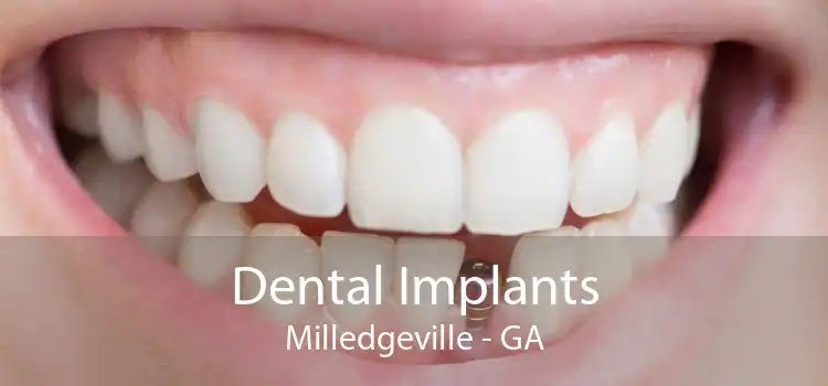 Dental Implants Milledgeville - GA