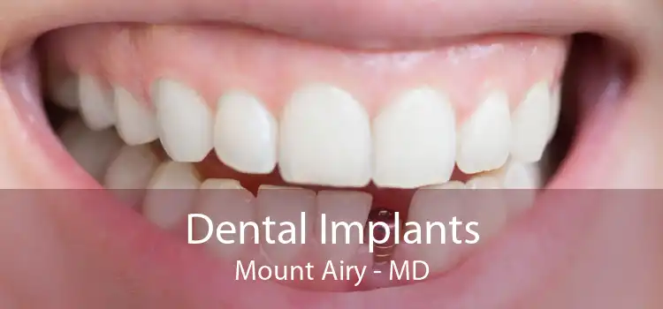Dental Implants Mount Airy - MD