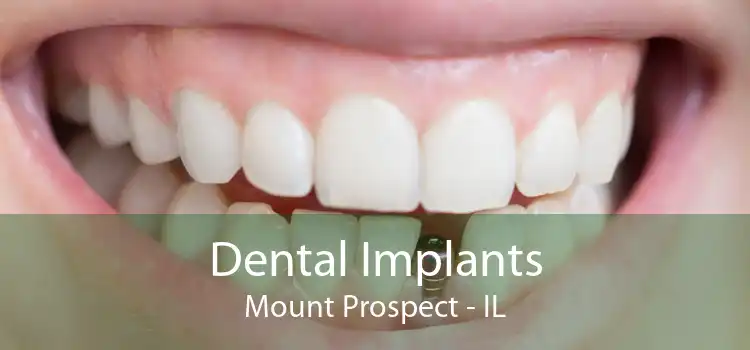 Dental Implants Mount Prospect - IL