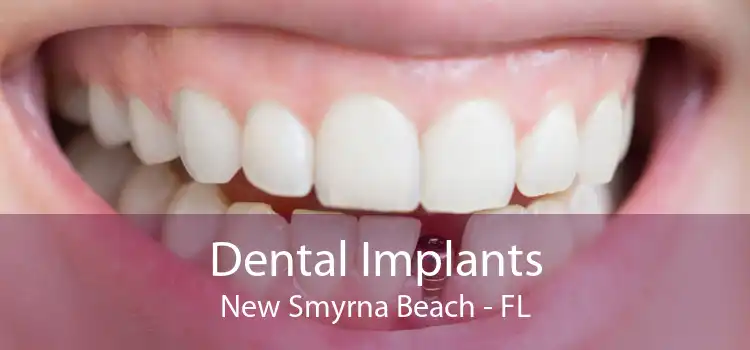 Dental Implants New Smyrna Beach - FL