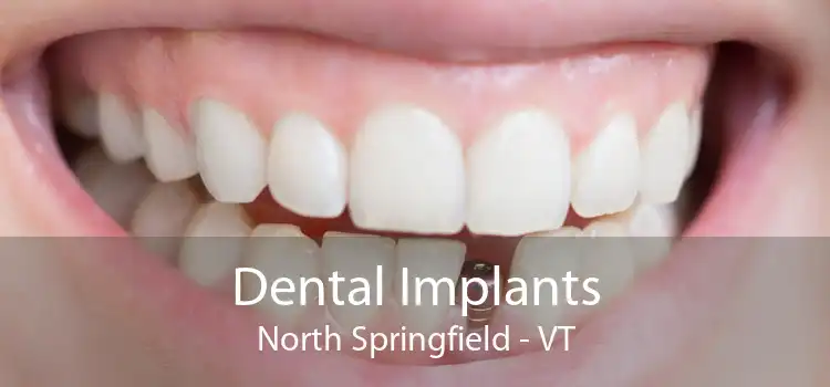 Dental Implants North Springfield - VT