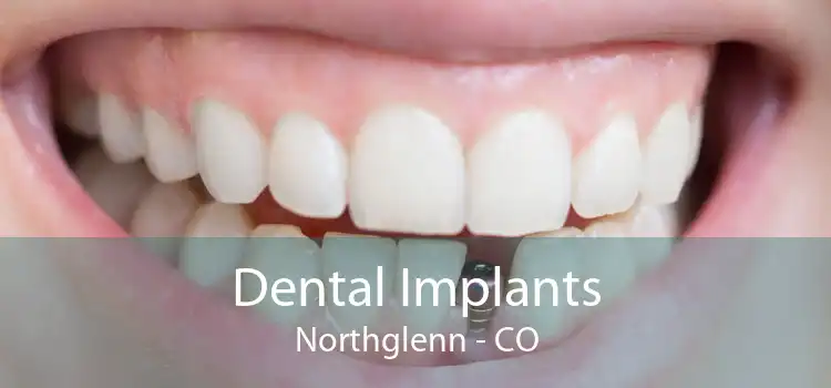 Dental Implants Northglenn - CO