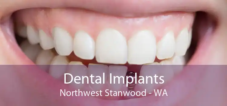 Dental Implants Northwest Stanwood - WA