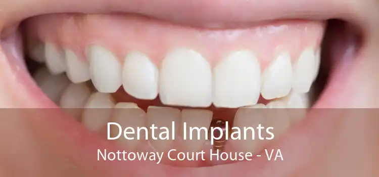 Dental Implants Nottoway Court House - VA