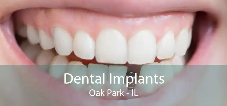 Dental Implants Oak Park - IL