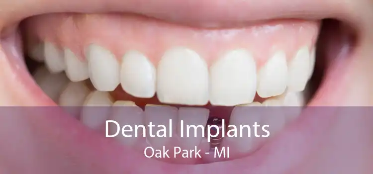Dental Implants Oak Park - MI