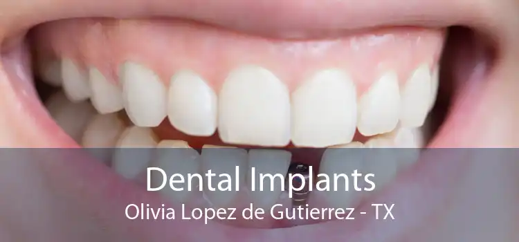 Dental Implants Olivia Lopez de Gutierrez - TX