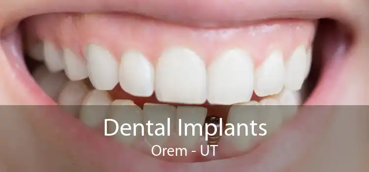 Dental Implants Orem - UT