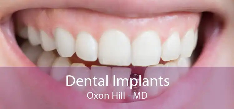 Dental Implants Oxon Hill - MD