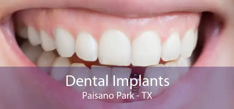 Dental Implants Paisano Park - TX