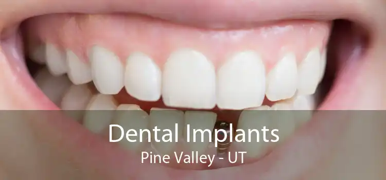 Dental Implants Pine Valley - UT