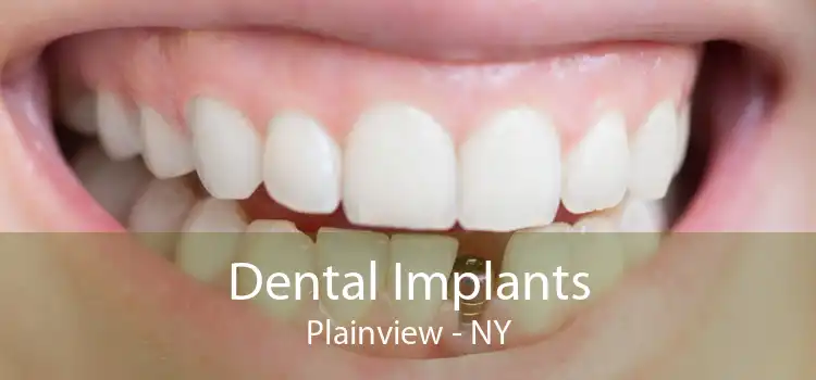 Dental Implants Plainview - NY